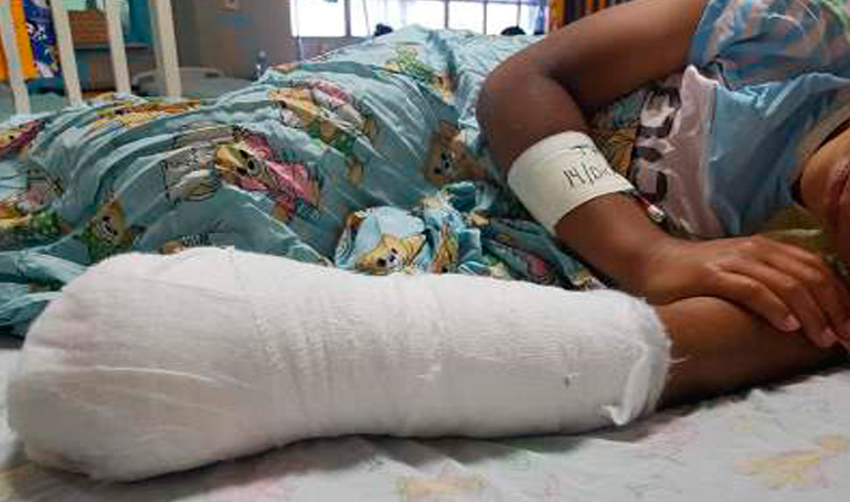 Alumno de un Instituto de San Miguel pierde cuatro dedos luego de un "experimento" ideado por su profesor - Diario Digital Cronio de El Salvador